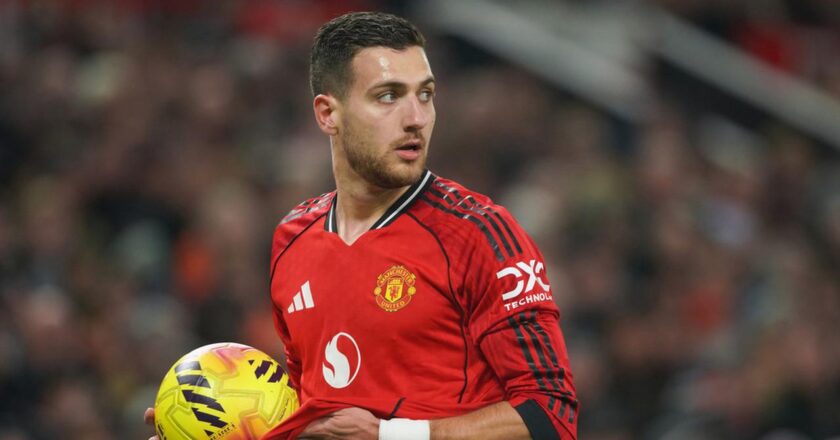 Diogo Dalot Buka Suara tentang Fans MU yang Viral karena Tidak Potong Rambut